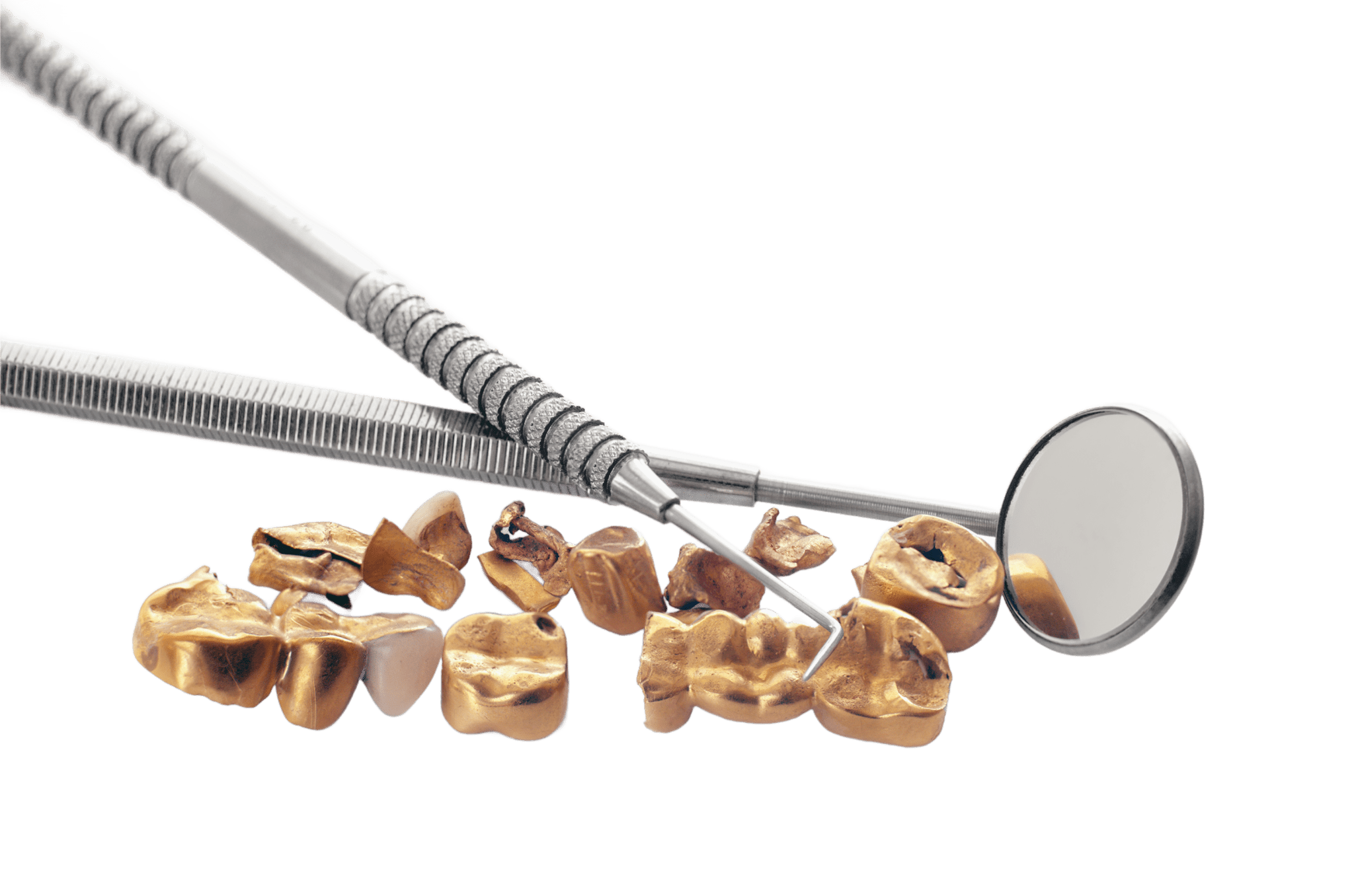 shutterstock_309275003_edited-dental-gold